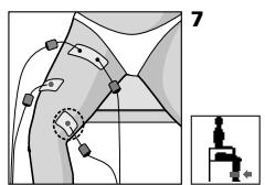 COMPEX MI THETA PRO - Rééducation du quadriceps après une ligamentoplastie du ligament croisé antérieur (LCA) - 1