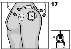COMPEX MI THETA PRO - Placement des électrodes et position du corps - 1