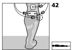 COMPEX MI THETA PRO - Traitement de l'insuffisance artérielle - 1