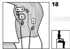COMPEX MI THETA PRO - Placement des électrodes et position du corps - 2