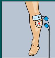 COMPEX MI THETA PRO - ESTHETIQUE - 6