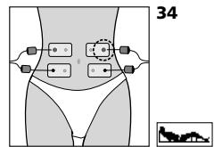COMPEX MI THETA PRO - Placement des électrodes et position du corps - 3