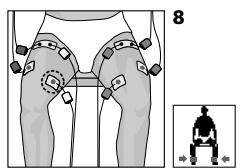 COMPEX MI THETA PRO - Placement des électrodes - 1
