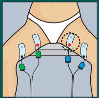 COMPEX MI THETA PRO - ESTHETIQUE - 2
