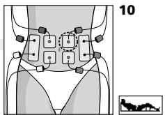 COMPEX MI THETA PRO - Placement des électrodes et position du corps - 1