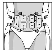 COMPEX MI THETA PRO - Placement des électrodes et position du corps - 4