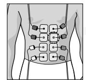 COMPEX MI THETA PRO - Placement des électrodes et position du corps - 2