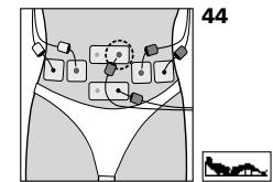 COMPEX MI THETA PRO - Placement des électrodes et position du corps - 2