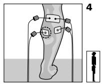 COMPEX MI THETA PRO - Durée du traitement - 1