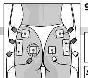COMPEX MI THETA PRO - Placement des électrodes et position du corps - 1