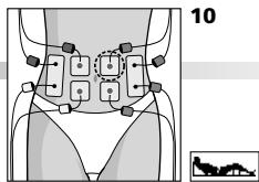 COMPEX MI THETA PRO - Placement des électrodes et position du corps - 1