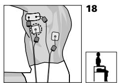 COMPEX MI THETA PRO - Placement des électrodes et position du corps - 1