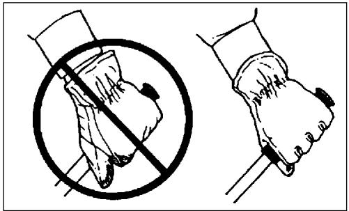 ECHO HC-2400 TYPE 1E - Repetitive Stress Injuries - 3