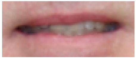 GENIUS SLIM 311R - - How can I improve the mouth movements for a photo with an open mouth? - 1