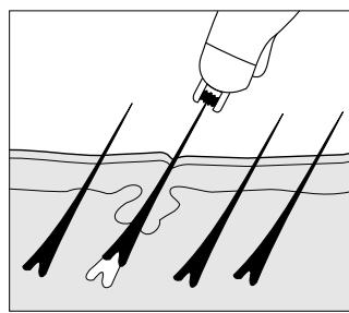 IBP EPILATEUR - Volume de livraison - 3