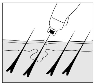 IBP EPILATEUR - Volume de livraison - 2
