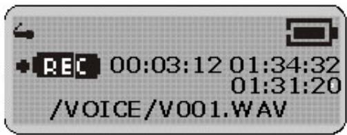 YAKUMO HYPERSOUND XR - Enregistrement vocal - 1