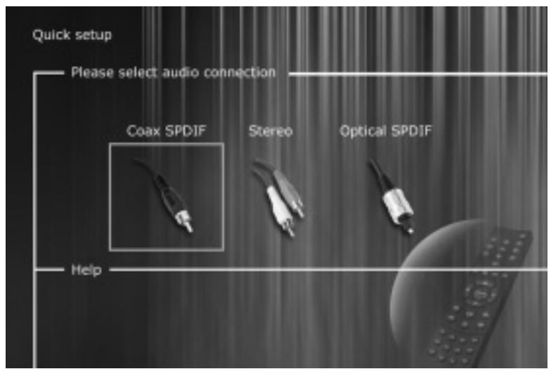 KISS DP-500 - Connection - 3