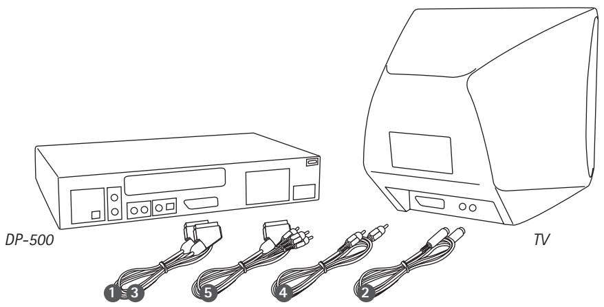 KISS DP-500 - Accessories and Connections - 9