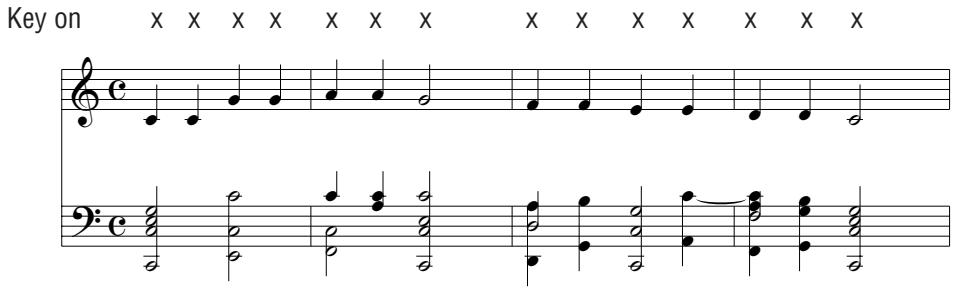 KAWAI CL20 - Melody Play - 1