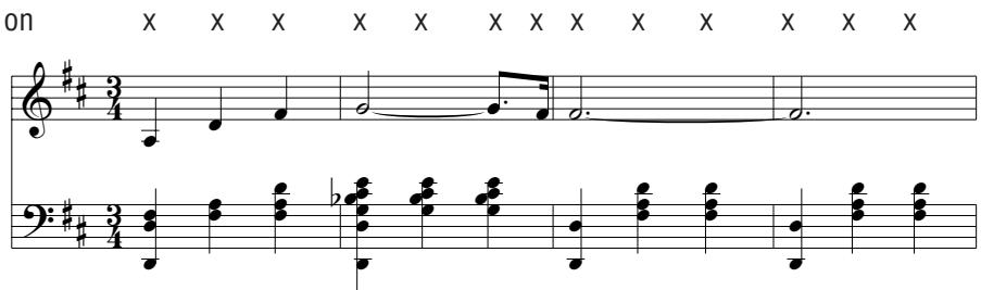 KAWAI CL20 - Skillful - 1