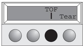 TALLYGENICOM T2340-24 - Erste Druckzeile einstellen (TOF) - 6