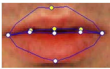 GENUIS SLIM 1320 - - How can I improve the mouth movements for a photo with an open mouth? - 5