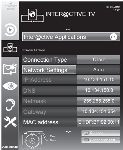 GRUNDIG 39VLE931BH - Automatic connection - 1