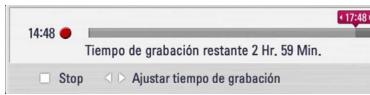 LG HR939D - Grabación programada instantánea - 1