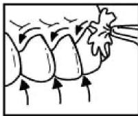 SPORT ELEC HC5 - DENTAL JET - 2
