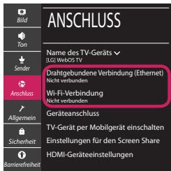LG 65UM7000PLA - Netzwerkeinstellungen - 2