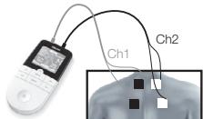 BEURER EM49 - Information regarding the positioning of electrodes - 1
