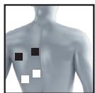 BEURER EM49 - Information regarding the positioning of electrodes - 9