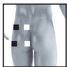 BEURER EM49 - Information regarding the positioning of electrodes - 23