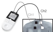 BEURER EM49 - Indicaciones para la colocacion de los electrodos - 1
