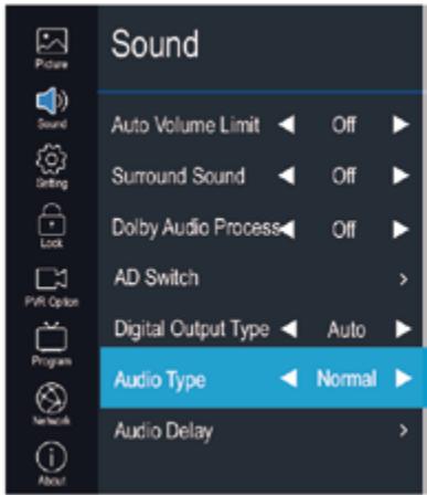 EDENWOOD ED50A01UHD-MM - Retard Audio - 1