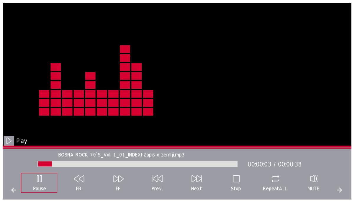 THOMSON 32HD2S13W - Menu Musique - 3
