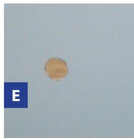 GRE CARRA 3 - FIXATION DU SKIMMER - 12