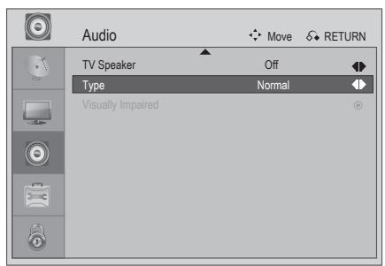 LG 223010 - Type - 1