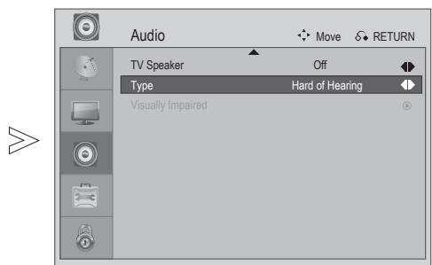 LG 223010 - Type - 2