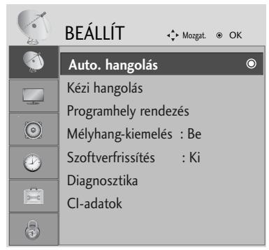 LG 42PG1000 - Automikus programbeállítás - 1