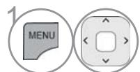 LG 32LD450 - EXPERT PICTURE CONTROL - 2