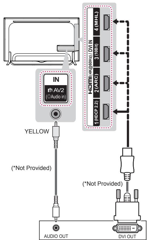 LG 55UB950V - DVI to HDMI Connection - 1