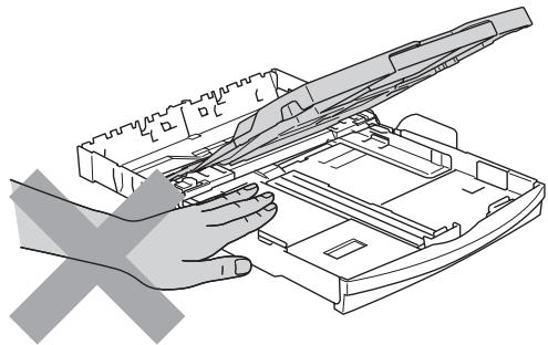BROTHER DCP-157C - WARNING - 9