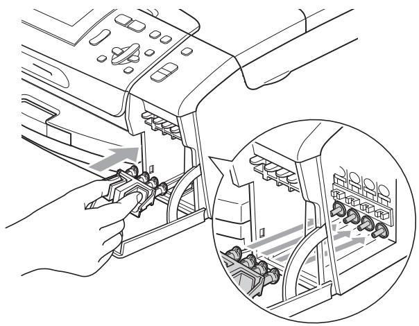BROTHER DCP-387C - ATTENTION - 1