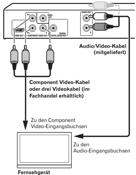 PIONEER DV-420V-S - Anschluss mit einem Component-Videokabel - 1