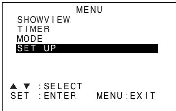 SHARP DV-NC65S - Deleting Channels - 1