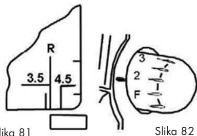 SILVERCREST SON 90 A1 OVERLOCK SEWING MACHINE - 3-nitni ometični zviti okrasni rob z zgornjim držalom - 2