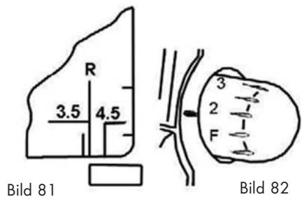 SILVERCREST SON 90 A1 OVERLOCK SEWING MACHINE - 3-trådig kast/rullsöm med övre gripare - 2