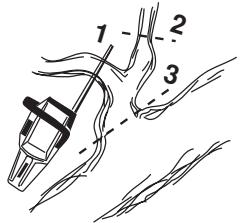 HUSQVARNA 460 RANCHER - Snoeien - 1